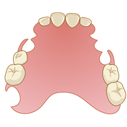 false-tooth009