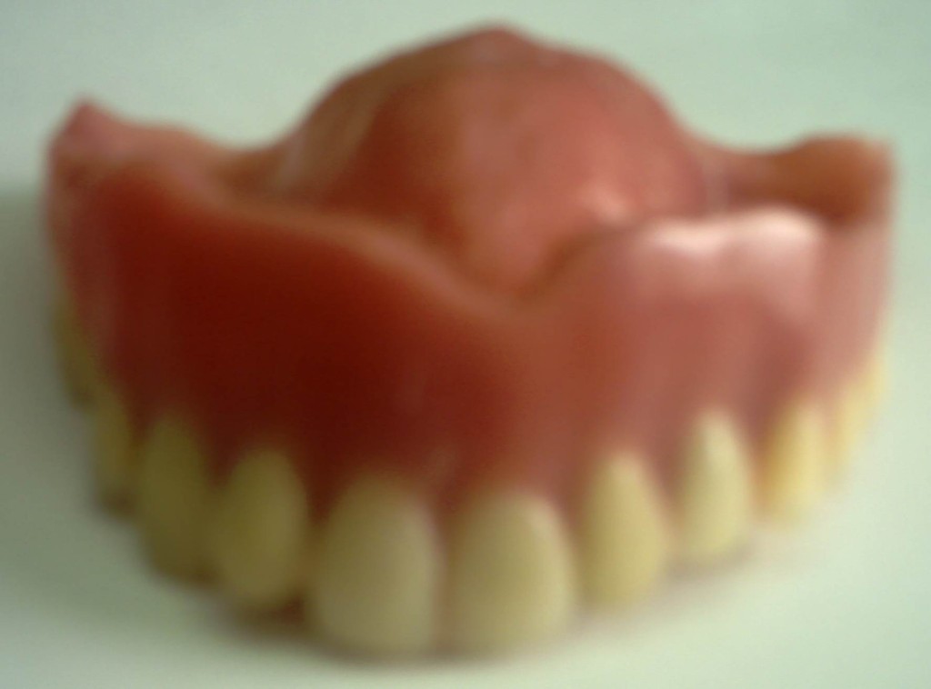レジン床義歯正面